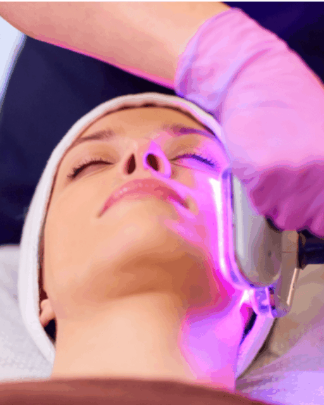 Soin Microneedling Radiofréquence-min